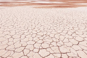 Natural Remedies for Dry Skin